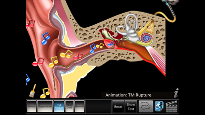 How to cancel & delete Otitis Media Disorders from iphone & ipad 4