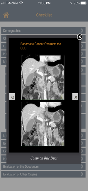 CTisus Pancreas Mass Checklist(圖4)-速報App