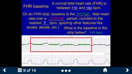 Game screenshot Fetal Heart Rate - SecondLook hack