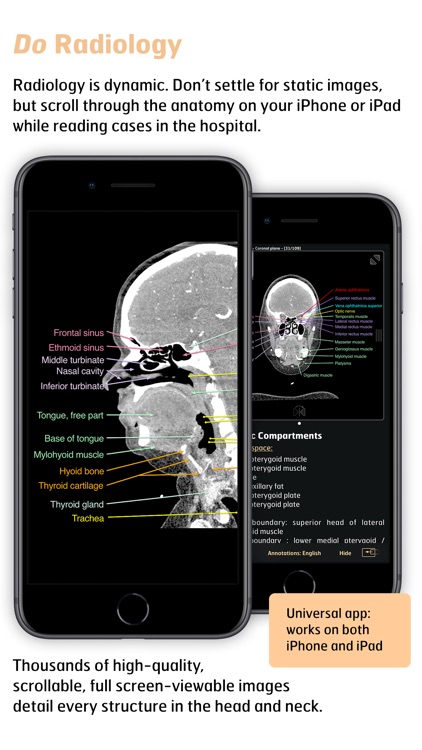 Radiology - Head&Neck Anatomy