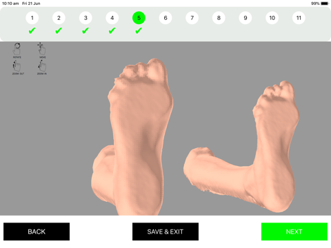 Ortesi Foot & Ankle screenshot 2