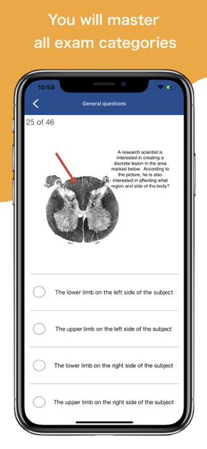 NEUROLOGY Review - Exam Prep(圖3)-速報App