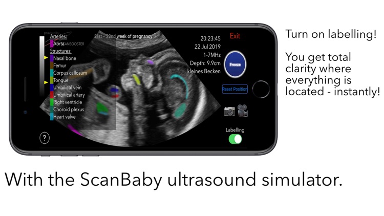 ScanBaby screenshot-5