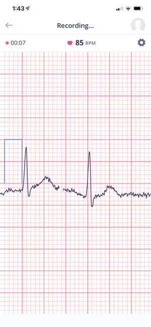 Cardiolyse(圖9)-速報App