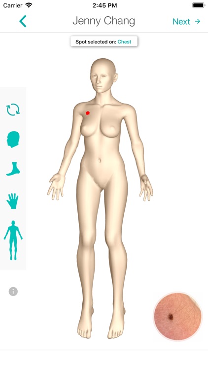 MoleScope™ screenshot-3