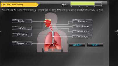 How to cancel & delete Human Anatomy for iPhone from iphone & ipad 3