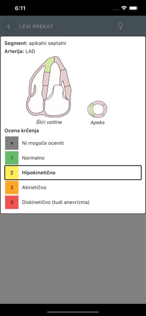 EhoKardio(圖3)-速報App