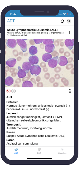 Microscopic Haematology(圖2)-速報App