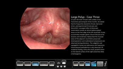 How to cancel & delete Vocal Pathology: Polyps from iphone & ipad 2