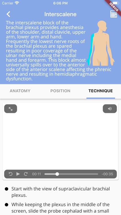 Regional Anesthesia Reference screenshot-4