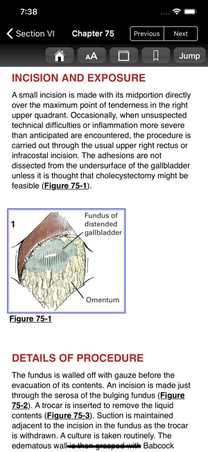 Zollinger Atlas of Surgery 10E(圖4)-速報App