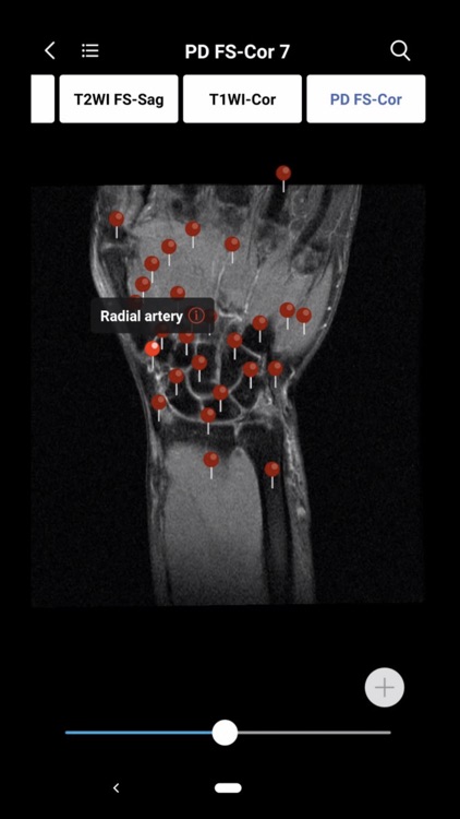 MedImaging-Radiology Made Easy screenshot-5
