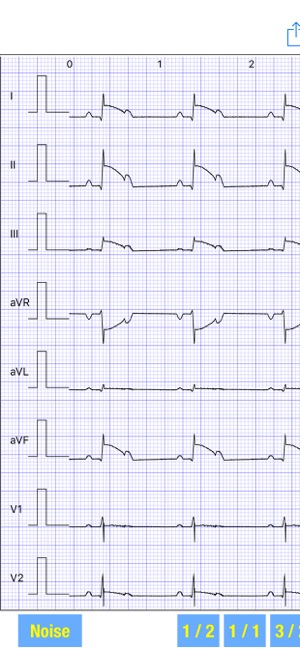 ECG Simulator(圖4)-速報App