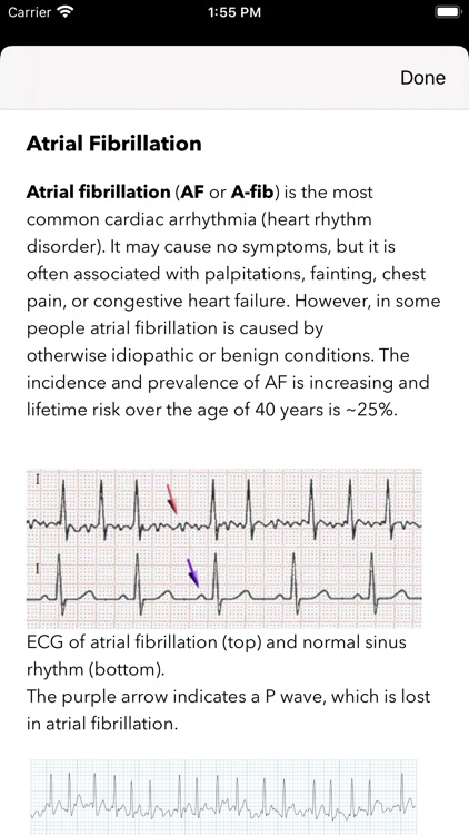 ECG / EKG screenshot-6