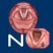 The Vocal Pathology: Neurological app helps students and patients learn and professionals teach vocal pathologies