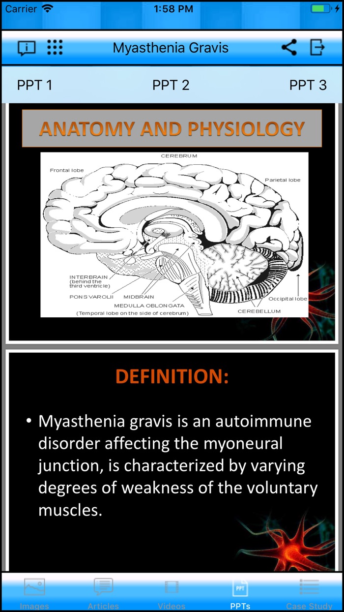 Myasthenia Gravis