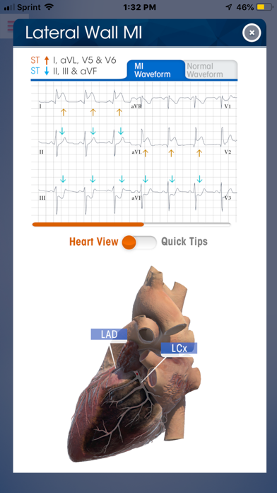 How to cancel & delete NK 12-Lead ECG Wheel from iphone & ipad 3