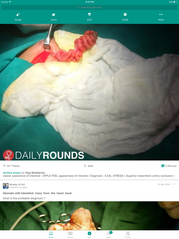 Screenshot #4 pour Anesthesia Rounds