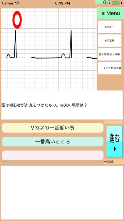 なんちゃって心電図全集(総集編):Drアニメ150問 screenshot-6