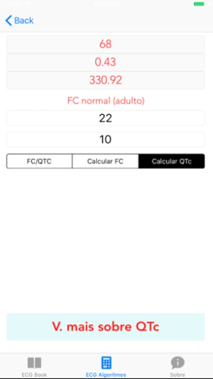 ECG Basico screenshot-5