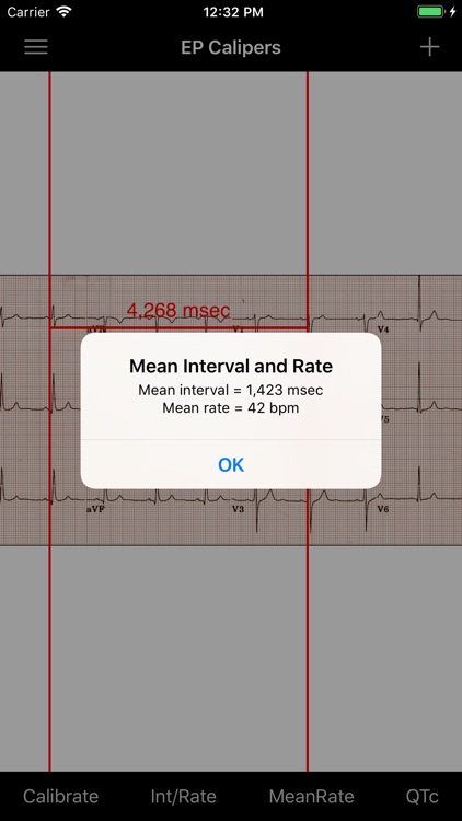 EP Calipers screenshot-4