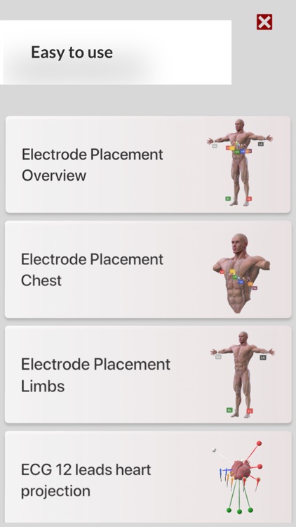3D ECG Leads screenshot-0