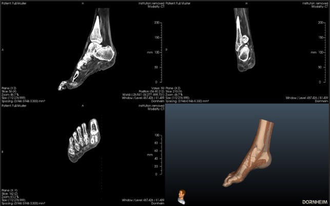 Dornheim DICOM Viewer(圖4)-速報App