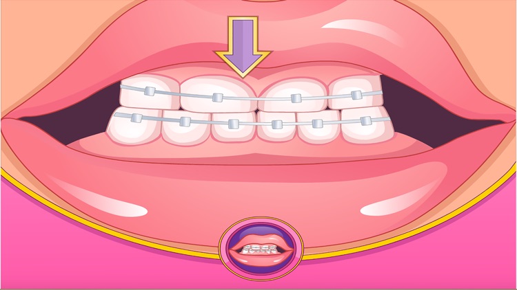 Bad Teeth Makeover Dentist screenshot-4