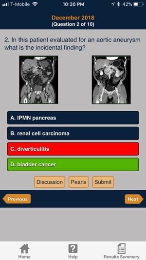 CTisus iQuiz(圖2)-速報App