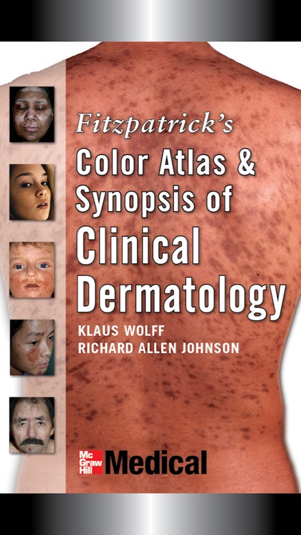 Fitzpatrick’s Clinical Derm 6E