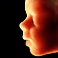 ScanBaby узнать ребенка УЗИ