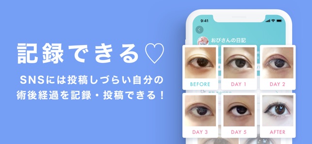 美容医療 整形の口コミ予約アプリ トリビュー をapp Storeで