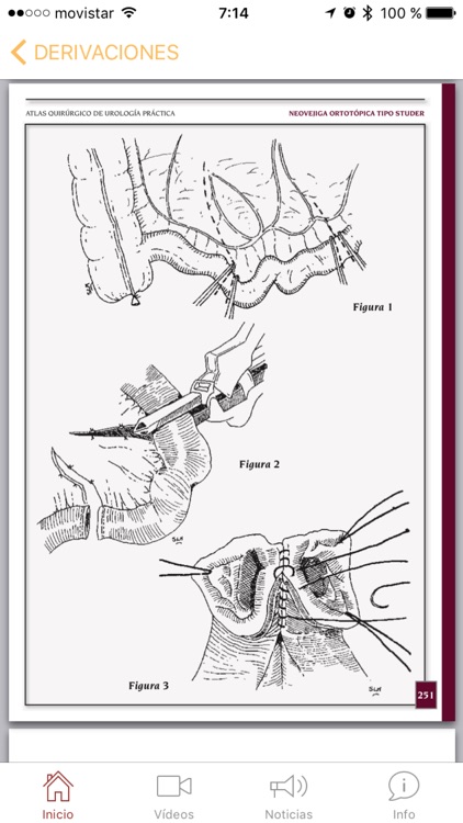 Atlas Quirúrgico de Urología screenshot-4