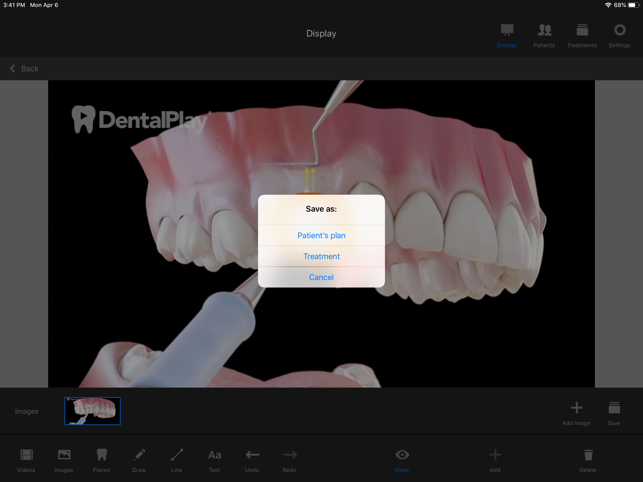 Dentool(圖4)-速報App