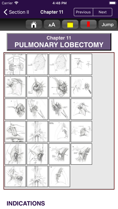 How to cancel & delete Atlas of Min. Invasive Surgery from iphone & ipad 3