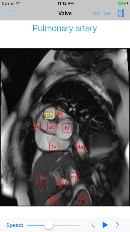 iAnatomy-Cardiac screenshot-2