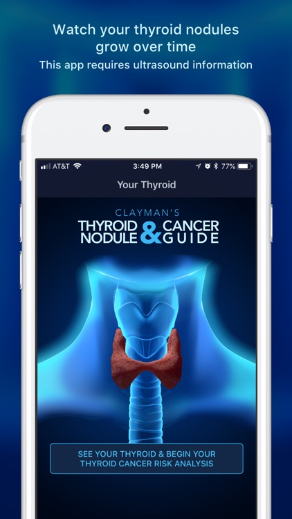 Thyroid Nodule & Cancer Guide