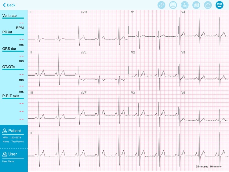 QT ECG Lite