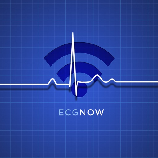 ECGNOW