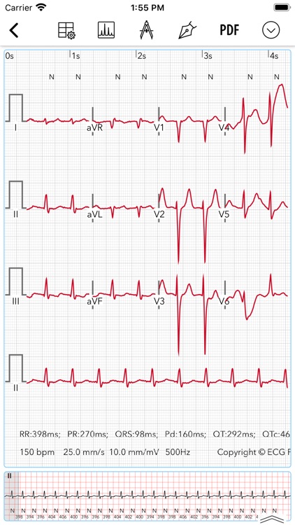 ECG Pro screenshot-3