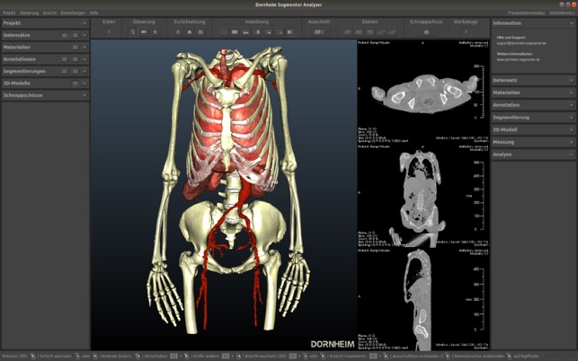 Dornheim DICOM Viewer(圖2)-速報App