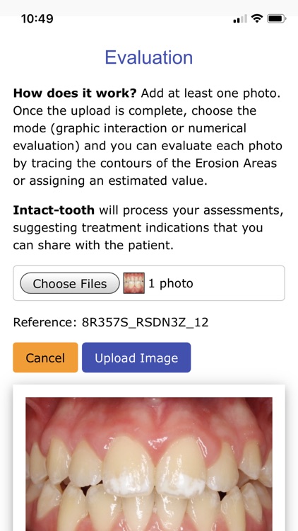 Intact-tooth screenshot-6