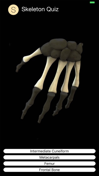 Human Skeleton Quiz screenshot 3