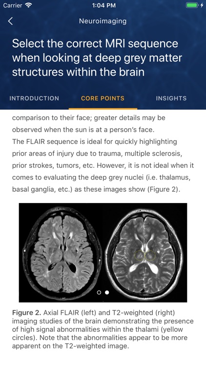 Top 50 Teachings in Neurology screenshot-4