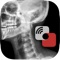 The Mobile MIM software program is used for the viewing, registration, fusion, and/or display for diagnosis of medical images from the following modalities: SPECT, PET, CT, MRI, X-ray and Ultrasound