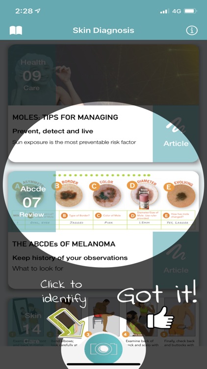 Skin Checker For Your Mole screenshot-3