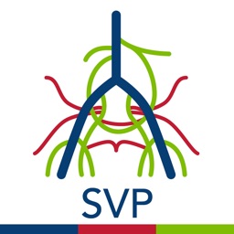 SVP Classifier