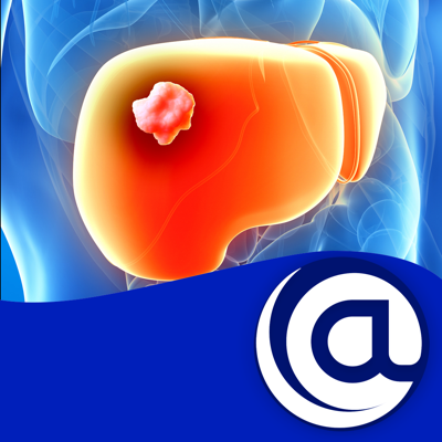 Hepatocellular Carcinoma @PoC