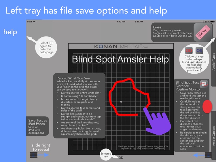 Amsler Grids screenshot-4