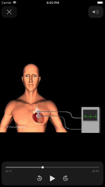 Cardiology Dictionary screenshot-4